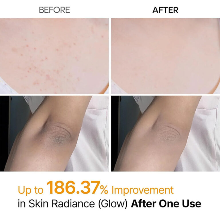 Dr.Melaxin-Peel-Shot-Keratin-Care-Kojic-Acid-Turmeric-Spray4-768x768