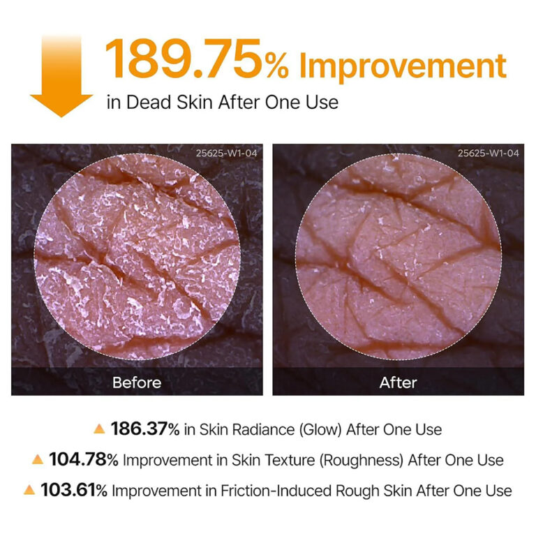 Dr.Melaxin-Peel-Shot-Keratin-Care-Kojic-Acid-Turmeric-Spray5-768x768